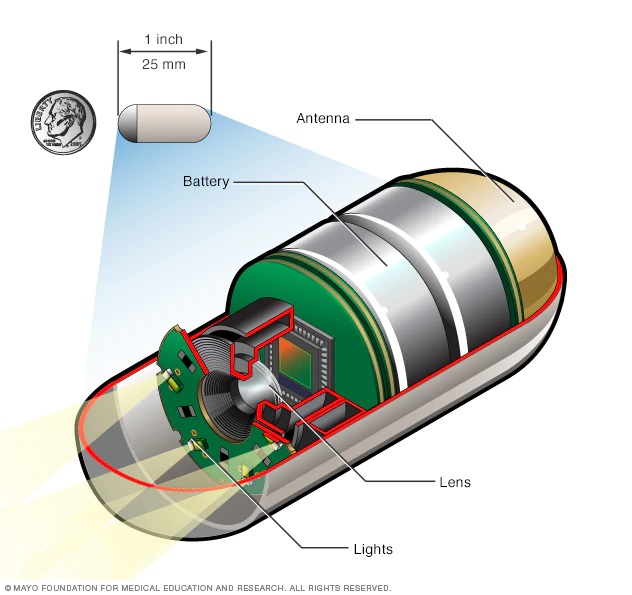 Pill Camera Technology